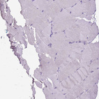 Immunohistochemical staining of human skeletal muscle shows no positivity in myocytes as expected.