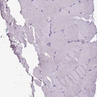 Immunohistochemical staining of human skeletal muscle shows no positivity in myocytes as expected.