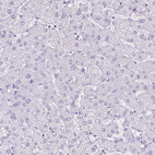 Immunohistochemical staining of human liver shows no positivity in hepatocytes as expected.
