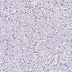 Immunohistochemical staining of human liver shows no positivity in hepatocytes as expected.