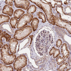 Anti-SLC16A4 Antibody