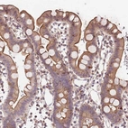 Immunohistochemical staining of human small intestine shows moderate membranous and cytoplasmic positivity in glandular cells.