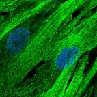 Immunofluorescent staining of human cell line BJ shows localization to microtubules.