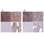 Immunohistochemical staining of human lymph node, rectum, skeletal muscle and testis using Anti-PSMB8 antibody HPA046995 (A) shows similar protein distribution across tissues to independent antibody HPA050327 (B).