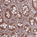 Immunohistochemical staining of human rectum shows strong cytoplasmic-nucleus positivity in glandular cells and lymphoid cells.