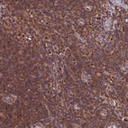 Immunohistochemical staining of human lymph node shows strong cytoplasmic-nucleus positivity in non-germinal center cells and germinal center cells.