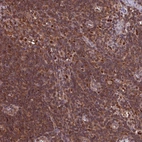 Immunohistochemical staining of human lymph node shows strong cytoplasmic-nucleus positivity in non-germinal center cells and germinal center cells.
