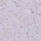Immunohistochemical staining of human skeletal muscle shows negative positivity in myocytes as expected.
