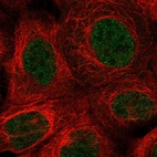 Anti-MSANTD1 Antibody