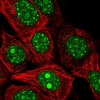 Immunofluorescent staining of human cell line MCF7 shows localization to nucleoli & nuclear speckles.