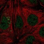 Anti-ST14 Antibody