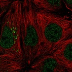 Anti-ST14 Antibody