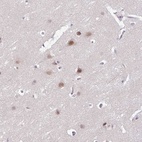 Anti-ACTR3 Antibody