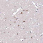 Anti-ACTR3 Antibody