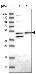 Anti-ACTR3 Antibody
