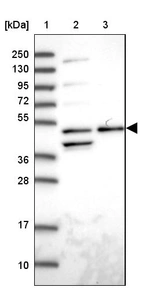 Lane 1: Marker [kDa] 250, 130, 95, 72, 55, 36, 28, 17, 10_br/_Lane 2: Human cell line RT-4_br/_Lane 3: Human cell line U-251MG sp