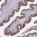 Anti-C19orf24 Antibody