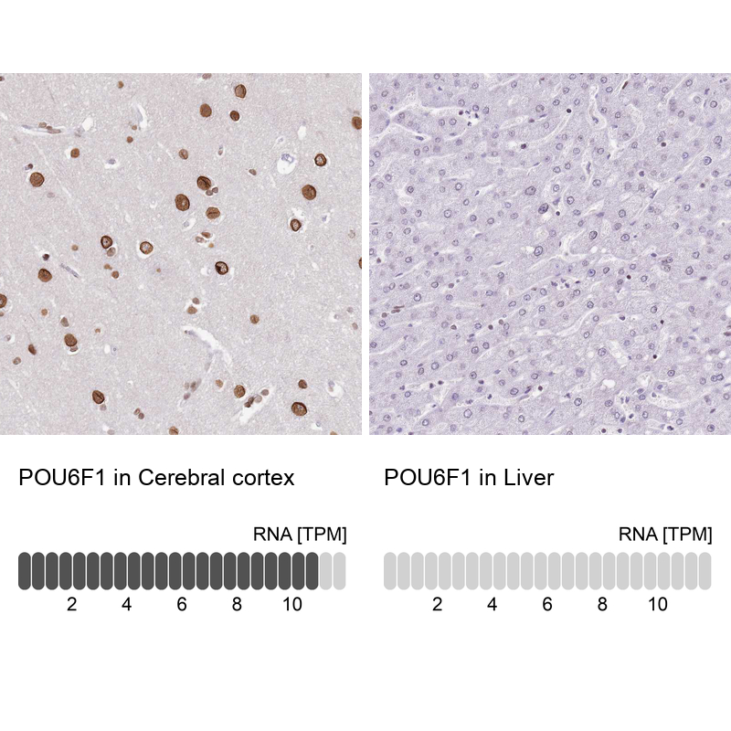 Anti-POU6F1 Antibody