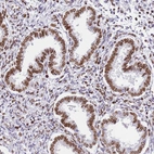 Immunohistochemical staining of human endometrium shows strong nuclear membrane positivity in glandular cells.
