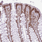 Immunohistochemical staining of human colon shows moderate nuclear membrane positivity in glandular cells.