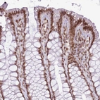 Immunohistochemical staining of human colon shows moderate nuclear membrane positivity in glandular cells.