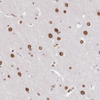 Immunohistochemical staining of human cerebral cortex shows strong nuclear membrane positivity in neurons.