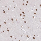 Immunohistochemical staining of human cerebral cortex shows strong nuclear membrane positivity in neurons.