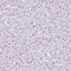 Immunohistochemical staining of human liver shows no positivity in hepatocytes as expected.