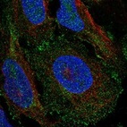 Immunofluorescent staining of human cell line U-2 OS shows localization to plasma membrane.