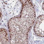 Anti-TRMT6 Antibody