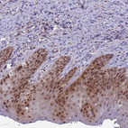 Immunohistochemical staining of human skin shows strong nuclear positivity in epidermal cells.