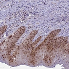 Immunohistochemical staining of human skin shows strong nuclear positivity in epidermal cells.