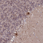 Anti-TRMT6 Antibody