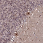 Immunohistochemical staining of human cerebellum shows strong nuclear positivity in Purkinje cells.