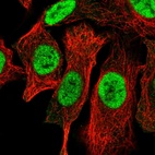 Immunofluorescent staining of human cell line A549 shows localization to nucleoplasm.
