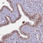 Immunohistochemical staining of human fallopian tube shows moderate nuclear positivity in glandular cells.