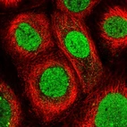 Immunofluorescent staining of human cell line A-431 shows localization to nucleus.