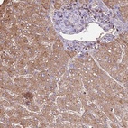 Anti-ARL10 Antibody