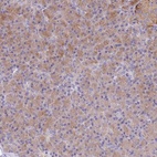 Anti-TYW1B Antibody