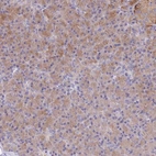 Anti-TYW1B Antibody