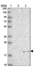 Lane 1: Marker [kDa] 250, 130, 95, 72, 55, 36, 28, 17, 10_br/_Lane 2: Human cell line RT-4_br/_Lane 3: Human cell line U-251MG sp