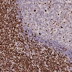 Immunohistochemical staining of human lymph node shows high expression.