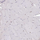 Immunohistochemical staining of human skeletal muscle shows low expression as expected.