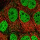 Immunofluorescent staining of human cell line CACO-2 shows localization to nucleoplasm.
