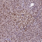 Anti-ESF1 Antibody