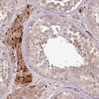 Anti-PDRG1 Antibody