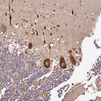 Anti-DDX27 Antibody