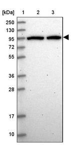 Lane 1: Marker [kDa] 250, 130, 95, 72, 55, 36, 28, 17, 10_br/_Lane 2: Human cell line RT-4_br/_Lane 3: Human cell line U-251MG sp