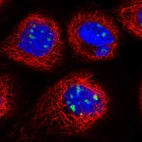 Immunofluorescent staining of human cell line A-431 shows localization to nucleoli.