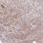 Anti-MOB1A Antibody